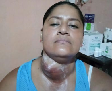 Ayuda a Patricia con morfina y tratamiento para su hijo