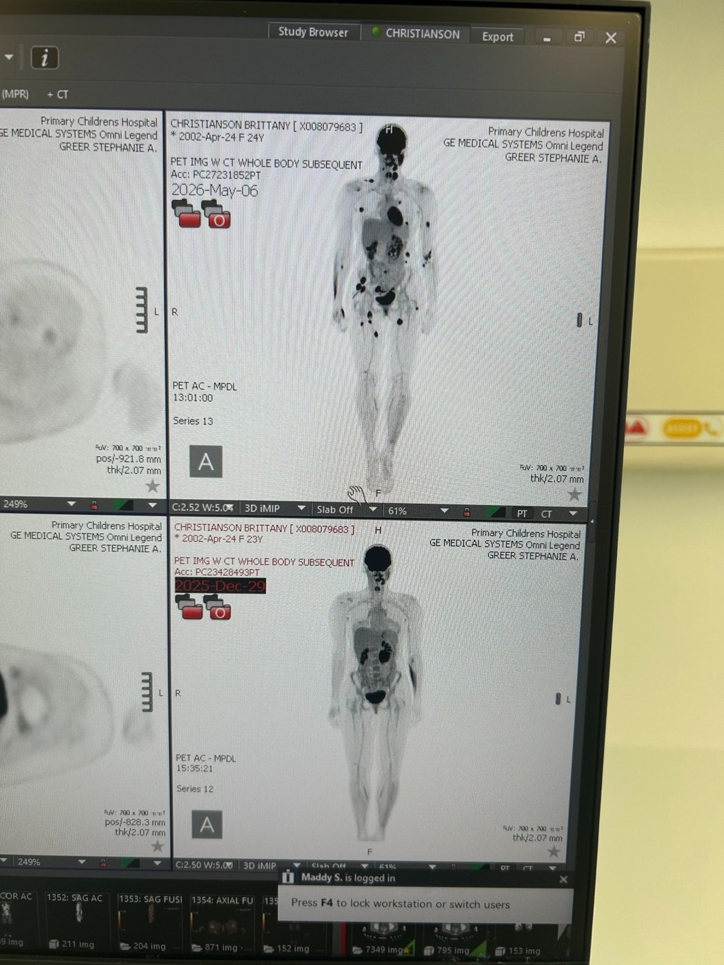 27 new tumors β help Brittany keep fighting cancer β photo 3