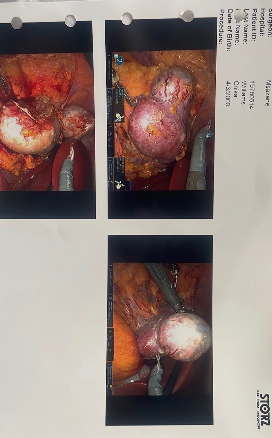 Help Chika Beat Cancer – Surgery No.4 & Restart Immunotherapy — photo 5