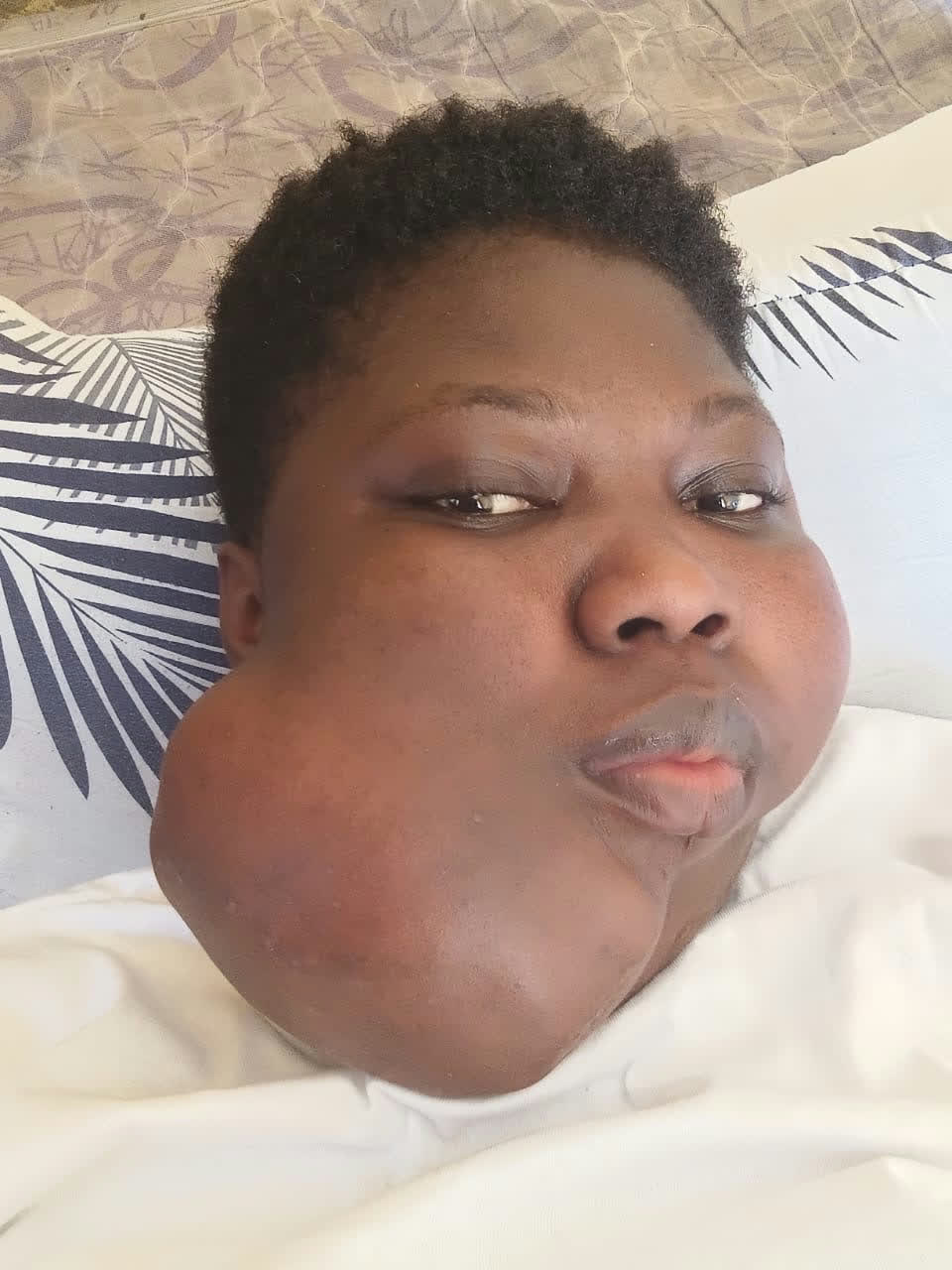 Help Joyce access urgent surgery for a severe jaw tumour — photo 2