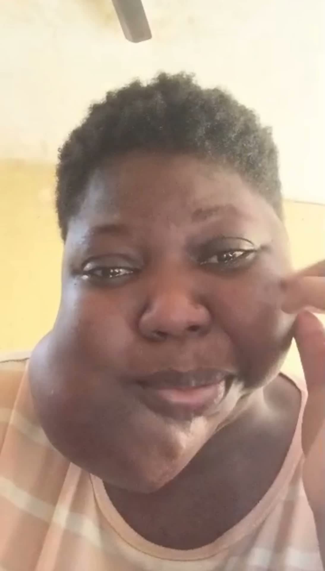 Help Joyce access urgent surgery for a severe jaw tumour — photo 4