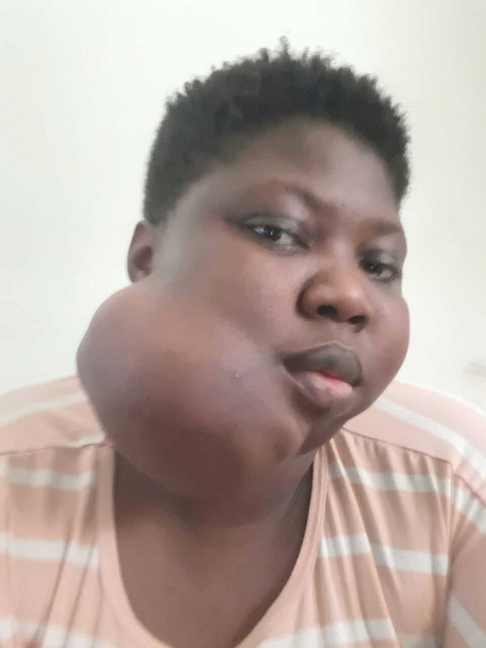 Help Joyce access urgent surgery for a severe jaw tumour — photo 5