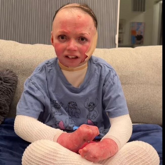 Please help Lilly fight skin cancer